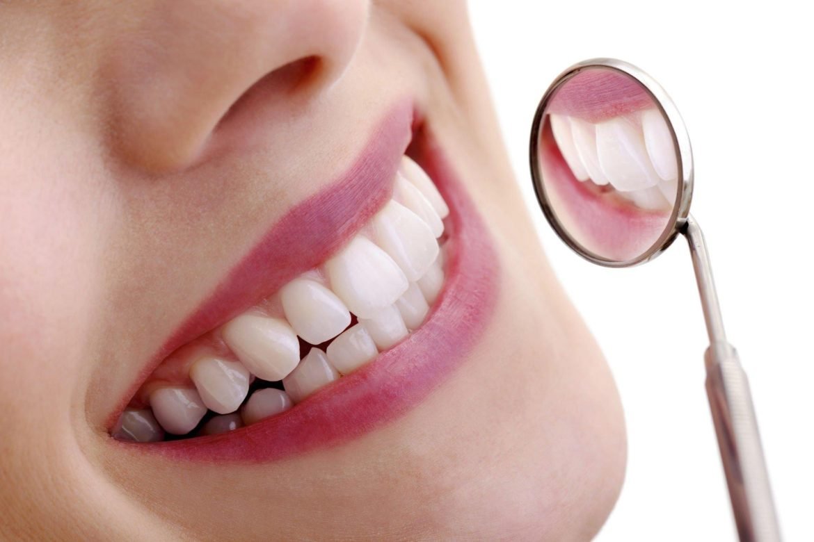 10 būdų kaip išlaikyti dantis baltais